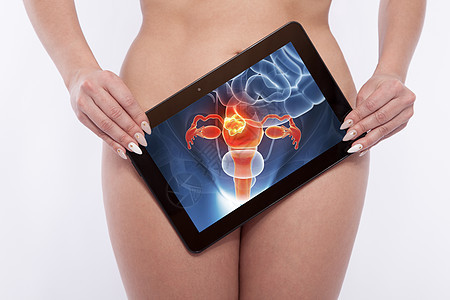 检查妇女生殖器官的再生产器官卵巢药品身体妇科医生药片女士咨询医疗宫颈妇科图片