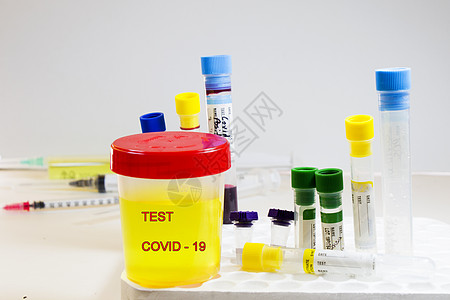 Covid19和corona病毒测试 医疗尿液和用白底血液和其他输血管进行尿检报告医院实验室液体糖尿病药品试管诊所疾病治疗背景