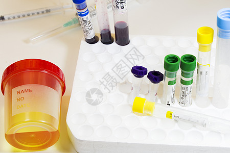 白底 彩色实验室检测容器上含血和其他管子的药物测试 医疗尿液和尿尿检验生物诊断样本兴奋剂治疗糖尿病分析葡萄糖医学液体图片