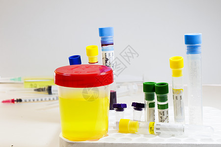 白底 彩色实验室检测容器上含血和其他管子的药物测试 医疗尿液和尿尿检验报告治疗诊所疾病液体感染糖尿病尿素生物诊断图片