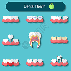 牙科护理平面设计矢量插图健康的 theeth 龋齿 牙套系统 植入和其他牙科健康图标集工具美白牙齿椅子治疗牙医镜子注射器口腔科卫图片