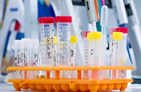 桌子上有测试管的三脚架科学家们科学化学品管子化学蓝色医疗数字生物黄色图片