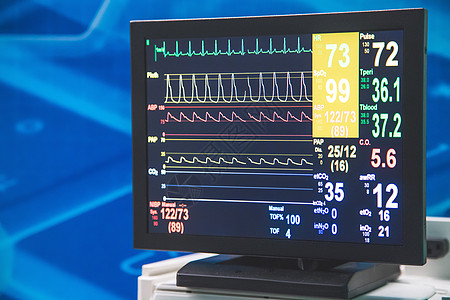 监测病人的病情和生命迹象 在医院 特别护理中配备监视器诊所技术医生情况电脑体系监控药品手术生活图片