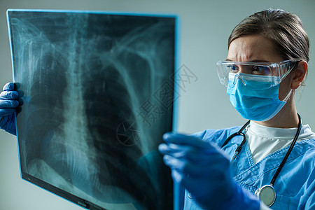 持有胸前X光片扫描仪的女GP医生图片