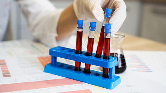 科学的手从站立处抽取血液采样管瓶子样本酒吧技术实验手套检查玻璃医院工具图片