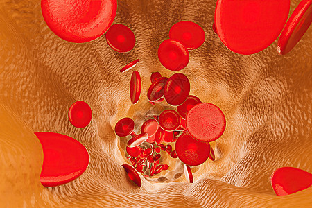 与胆固醇和红血细胞的静脉内部图片