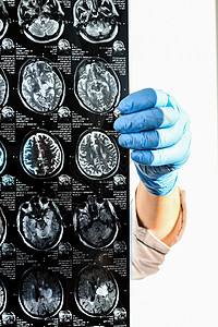 医生在医务室保护戴脑部核磁共振的手套 对诊所的人头进行核磁共振扫描生理断层技术治疗药品防护职业创伤测试卫生图片