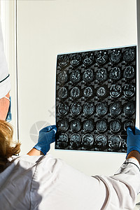 医生在医务室保护戴脑部核磁共振的手套 对诊所的人头进行核磁共振扫描断层癌症解剖学生理诊断考试药品医院x光检查图片
