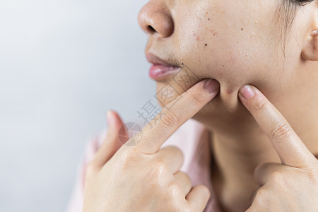 灰色背景有阴沟问题的年轻女性身体化妆品卫生手指血清女士保健成人感染疙瘩图片