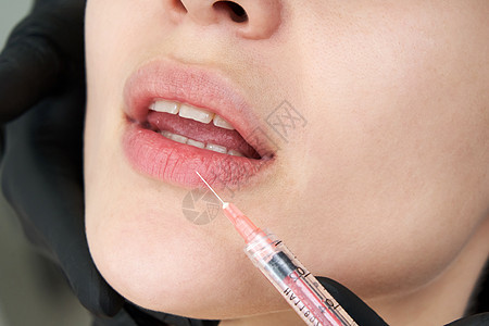 美丽的女人嘴唇要注射一针外科皮肤手术药品胶原女孩老化护理治疗女士图片