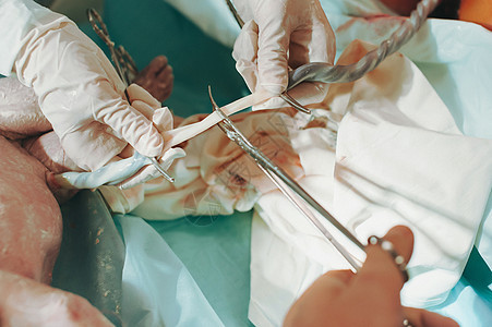 医生用夹子夹住新生儿的脐带 父亲在产房用剪刀剪断脐带 婴儿的出生 医疗保健的概念女孩父母男生生活护士诞生新生卫生分娩病人背景图片
