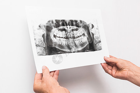 医生的手握着并检查了医疗办公室白底牙齿X光照片 该照片以白色背景显示图片