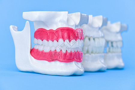 带有牙齿和口香糖的人体下巴解剖模型口服诊所卫生矫正塑料健康外科美白实验室解剖学图片
