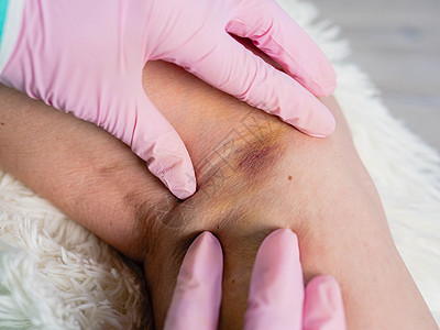 一名身戴医疗手套的外科医生将病人受伤腿转动 对伤者实行急救概念治愈理疗痛苦从业者血肿治疗师关节按摩膝盖创伤图片