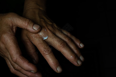 一位老年妇女将手霜涂在皱纹的皮肤上润肤女士卫生皮肤科洗剂人手手臂治疗美容女性图片