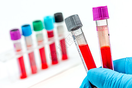 生物实验室中输血管的呈报情况医疗控制红色水平架子静物健康手套手势背景