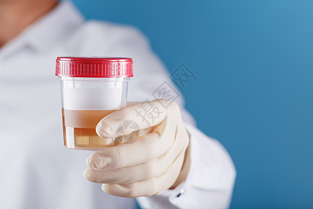 医生拿着塑料袋的尿液 以供分析技术药品治疗塑料测试女士尿素临床长袍实验室图片