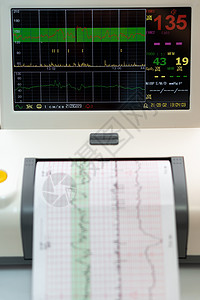 电子心电图机监测子宫胎心收缩 打印心电图报告在怀孕期间在劳动病房出来的心电图 医疗诊断设备健康病人办公室电脑男人孕肚女性保健温泉图片