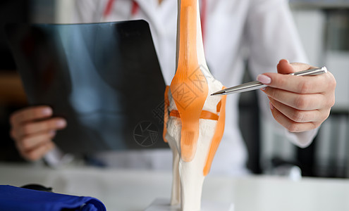 手持X光片的医生在人工模型闭合时显示膝关节结构图片
