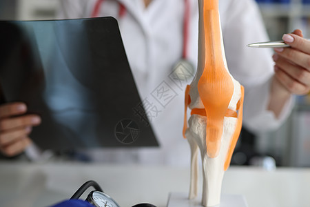 医生创伤学家在人工模型上展示膝关节骨 并进行X光照片近身检查图片