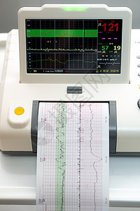 电子心电图机监测子宫胎心收缩 打印心电图报告在怀孕期间在劳动病房出来的心电图 医疗诊断设备诊所治疗医生卫生婴儿女人夫妻按摩考试男图片