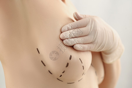 未来化妆外科手术在胸罩上打标记的女客户背景图片