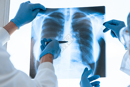 医疗同事在讨论肺部X光片的问题 笑声疾病肺炎男性放射科射线x射线技术哮喘诊所工作图片