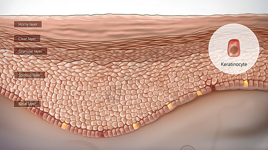皮肤解解剖结构卵泡晒斑疼痛器官生物学头发身体表皮事故细胞图片