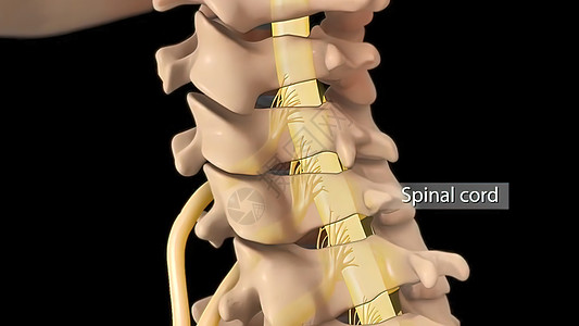 脊柱外科子宫颈脊椎的解剖视图 以及间脊椎结膜抑制神经根骨折医院椎骨骨科疝气手术外科脊柱绳索疼痛柱子背景