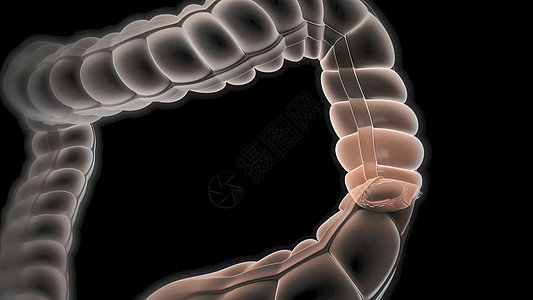 切除肠道任何部分的外科手术 肠内分解大肠解剖学癌症绘画图表外套便秘眼镜粘膜卫生图片