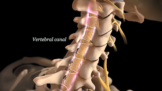 脊柱外科有神经根的人类脊椎骨赘外科整脊绳索药品脊髓光盘运河脊柱椎间背景