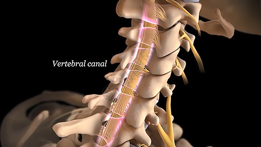 脊柱外科有神经根的人类脊椎骨赘脊髓疾病脊柱骨骼绳索疼痛柱子治疗骨干背景