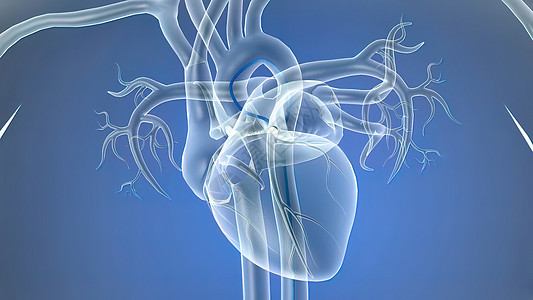 插入一个支节打开隐蔽的动脉药品手术外科细胞诊断心脏病学心血管动脉硬化疾病医生图片