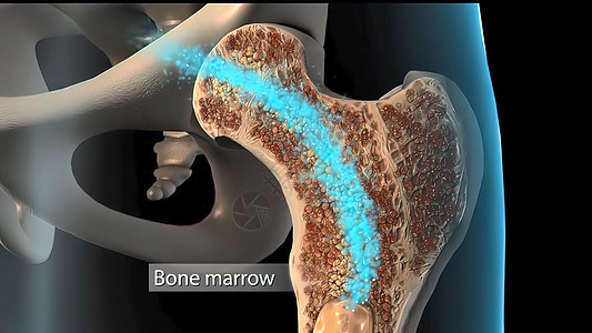 将人体骨质骨质疏松症海绵组织从正常组织发展成病人组织软骨生物学药品修理身体骨细胞科学人骨骨骼康复图片