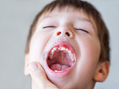 孩子嘴里有一排牙齿洞 刚才有个牙缝掉了出来 给牙医贴上口香糖的照片图片