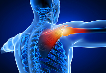 3d在医学上准确无误地说明一名男子肩膀疼痛图片
