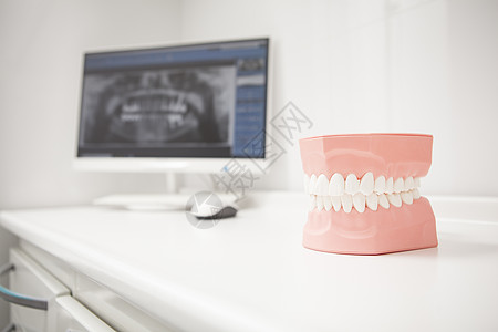 牙科诊所的Jaw模型 背景计算机X光扫描图片