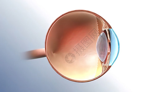 Glaucoma眼病 3D例感染保健皮肤药品医生疼痛宏观细菌皮肤科脓肿图片