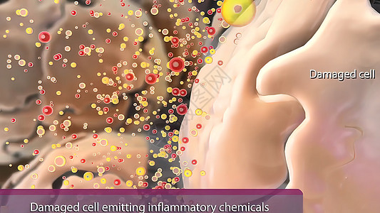 炎症是身体对损伤的标准初始反应细胞插图血管血细胞微生物学皮肤疾病损害感染科学图片