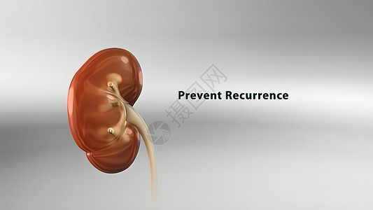 人体肾结石的历程微生物学解剖学输尿管疾病插图图表科学肾脏病理身体背景图片