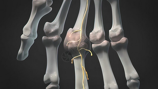 肿胀和发炎的手指关节风湿病医生手腕科学身体解剖学按摩神经伤害疼痛图片