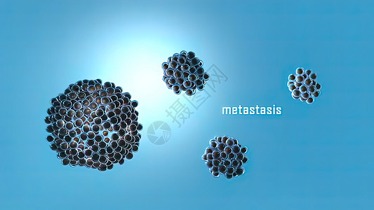 癌症的代谢性肿瘤扩散到身体的不同部位 从那里蔓延到文件抗体绘图新生活疾病细胞防御微生物学人体分子图片