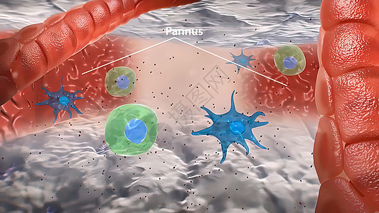 T细胞大型巨形相互作用和血管炎中形成颗粒瘤癌症药品疾病生物学细菌生物免疫学攻击毒性抗体图片