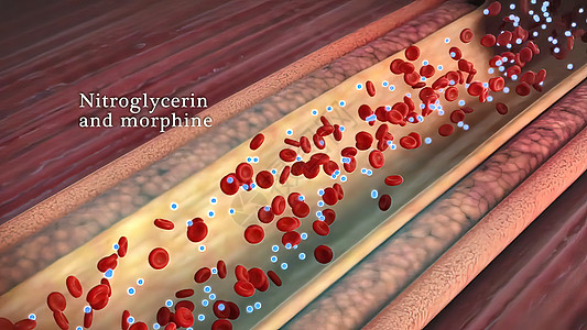 尼古丁会提高血压组织攻击阀门肌肉主动脉心脏病学图表心肌卡通片插图背景图片