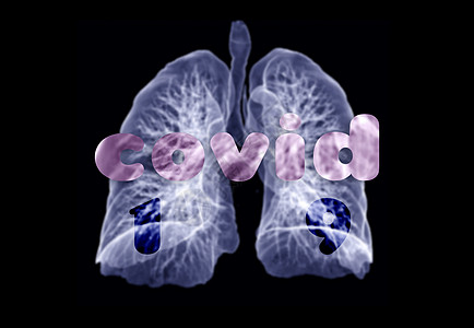 CT 肺3d 肝脏成象胸部插图肋骨扫描监控科学屏幕辐射胸椎ct图片