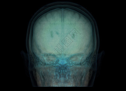以大脑为主的  Skull  透明图像用于医学背景概念思考核磁共振病人药品医院扫描出血治疗脑血管射线图片