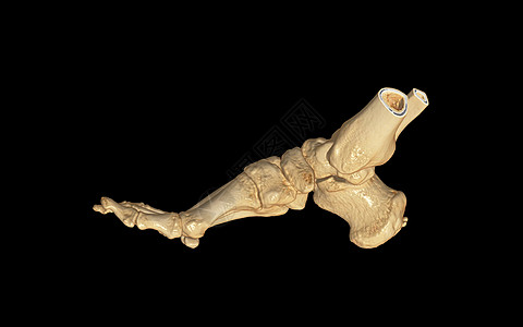 CT 右脚扫描 3D 显示图像横向视图 医疗技术概念图片