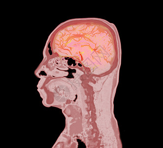头图大脑扫描意志力圈高清图片