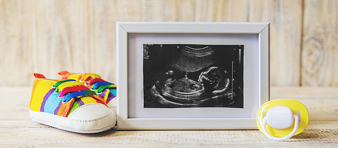 婴儿的照片和配件的超音速照片 有选择的聚焦点胚胎孩子子宫男生声呐怀孕扫描生活新生横幅图片