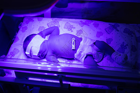 紫外线灯下的新生儿 有选择的焦点药品孵化器孩子监控横幅男生新生剖腹产病人儿科图片